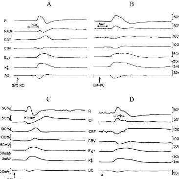 Fig. 2. Effects of hypoxia (B) and partial ischemia (D) on the various responses to CSD compared to the control normoxic state (A) and to the normoxicsham brain (C), respectively