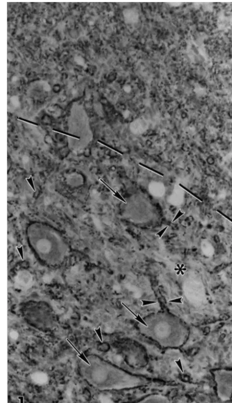 Fig. 1. Photomicrograph of synaptophysin immunostained portion ofventral gray matter from a 63-day-old irradiated rat