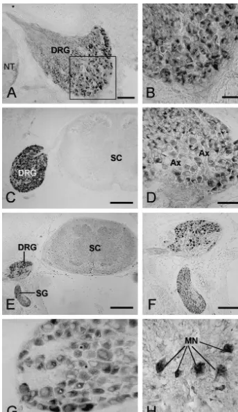 Fig. 1. Micrographs of the transverse sections through chicken embryos stained for estrogen receptor (ER) from 8.5 to 18.5 days of development
