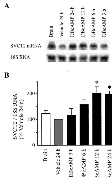 Fig. 1. Northern blot analysis of SVCT2 expression in total RNA fromrat brain and primary cultures of cerebral astrocytes