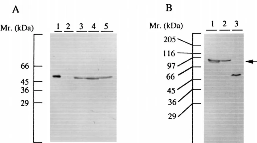 Fig. 1. Detection of CaM kinase II and its mutants in Nb2a cells stably expressing the enzymes and GFP-tagged kinases by immunoblotting