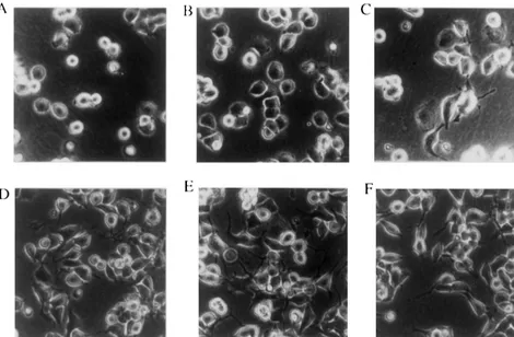 Fig. 2. Morphological change of Nb2a/a cells. Nb2a/a cells were seeded at 2310 /well of 24-well plates, and photographed at 15 min, 30 min, 60 min,52 h, 4 h, and 8 h after stimulation by plating (A–F, respectively)