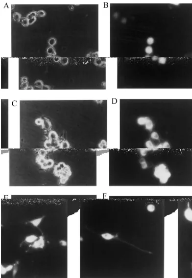 Fig. 3. Expression of GFP-CaM kinase II in Nb2a or Nb2a/a cells. Nb2a or Nb2a/a cells were transfected with pEGFP-C1/a DNA as described underMaterials and methods