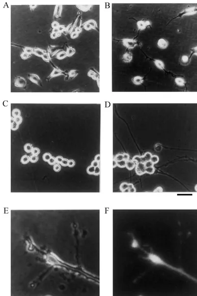 Fig. 5. Changes of morphology in cells expressing5A–E, phase contrast photomicrographs