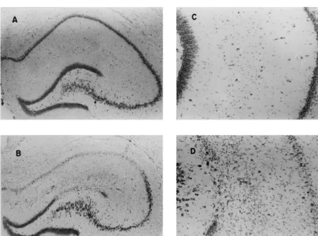 Fig. 1. Photomicrograph (403) of the hippocampal formation (Ammon’s Horn) for a control (A) and for a rat in which lithium/pilocarpine seizures hadbeen induced (B) showing loss of neurons in the dentate gyrus and CA1