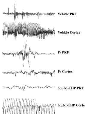 Fig. 3. Representative electrographic recordings from the motor cortex and pontine reticular formation (PRF) from a rat in each condition during the mostintense ictal activity