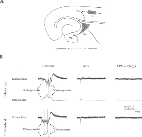 Fig. 1. Auditory cortex responses to subcortical and intracortical stimulation. (A) Schematic illustration of stimulation sites (grey areas) alongthalamocortical (SC) and intracortical (IC) ﬁber pathways (arrows) to AC
