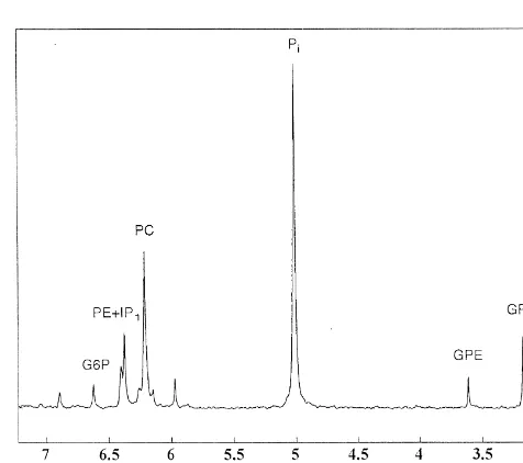 Fig. 6 shows a typical 202.3 MHz31and Table 1 illustrate the brain concentrations of IPphosphatesinositol, there was a signiﬁcant group effect with IPbrain extract