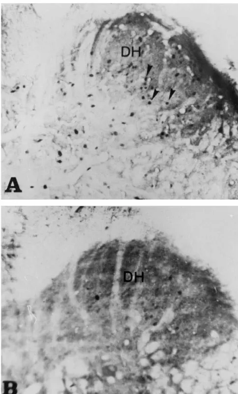 Fig. 3. Photomicrographs of a transverse section of the Sspinal cordshowing Fos-positive neurons in the dorsal horn area, (arrows)