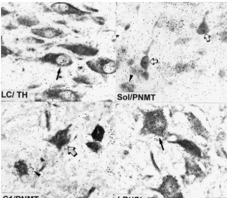 Fig. 4. TH-immunopositive neurons in the locus coeruleus (LC), PNMT-immunopositive neurons in the solitary tract nucleus (Sol), PNMT-immuno-positive neurons in area C1, and glutamate (Glu) immunopositive neurons in the lateral reticular nucleus (LRt)