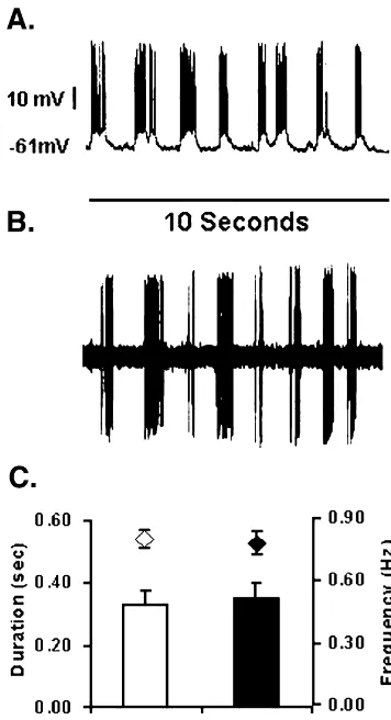 Fig. 1. Examples of intracellular and extracellular recordings of the Upand Down state membrane potential transitions and burst ﬁring of NAcintracellular (bursting action potential pattern