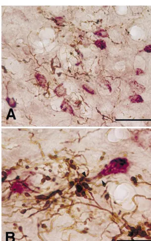 Fig. 2. Photomicrograph showing the overlapping distribution of CTb-labeled neurons (purple) and BDA-labeled axon terminals (brown) in the middlethird of the CL in rostrocaudal and dorsoventral axes after combined injection of BDA into the ipsilateral LCN,