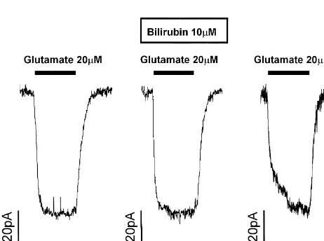Fig. 1. Bilirubin does not modulate NMDA receptor currents in rathippocampal pyramidal cells