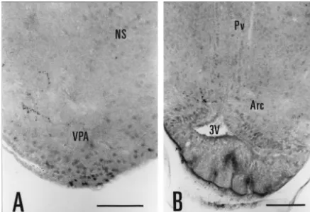 Fig. 4. Photomicrographs of AR-ir nuclei and ﬁbers in the female lizard brain (experiment L23)