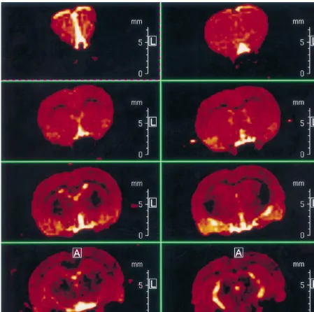 Fig. 1. (A) Sequential MRI scans of a sham operated control animal demonstrating normal brain morphology and signal intensity.