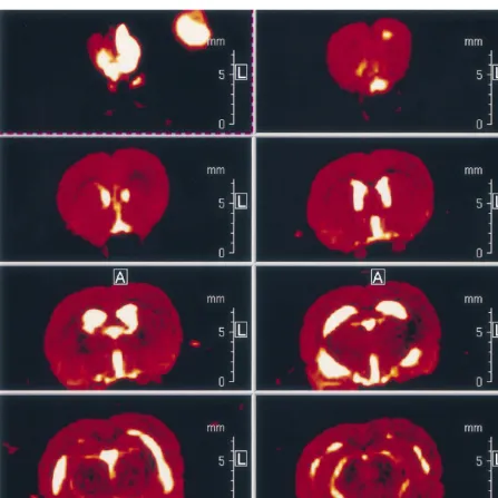 Fig. 1. (continued). (B) Sequential MRI scans of an olfactory bulbectomized rat. The bulbectomized animal exhibits pronounced enlargement of theventricles in addition to decreased caudate volume and cortical, amygdaloid and caudate signal hypointensities (see Table 1).