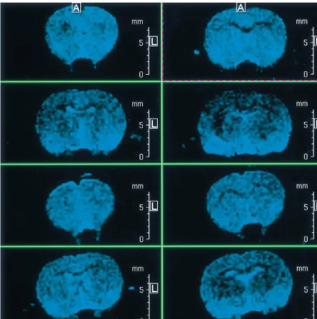 Fig. 2. (A) Sequential MRI scans of a sham operated control animal, following injection of a superparamagnetic contrast agent, magnetite-dextran (MD2),showing normal morphology and absence of contrast agent deposition.