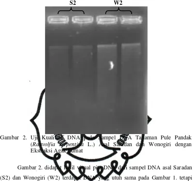 Gambar 2. didapat hasil visual pita DNA dari sampel DNA asal Saradan 