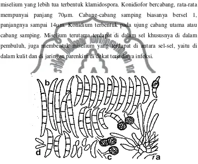 Gambar 2. Fusarium oxysporum (Sumber: University of Illinois 2010). 