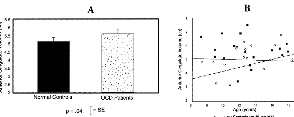 Figure 2. Anterior cingulate volume by group (A)disorder (OCD) patients as compared to healthy comparison subjects and anterior cingulate volume versus age for pediatric obsessive–compulsive (B).