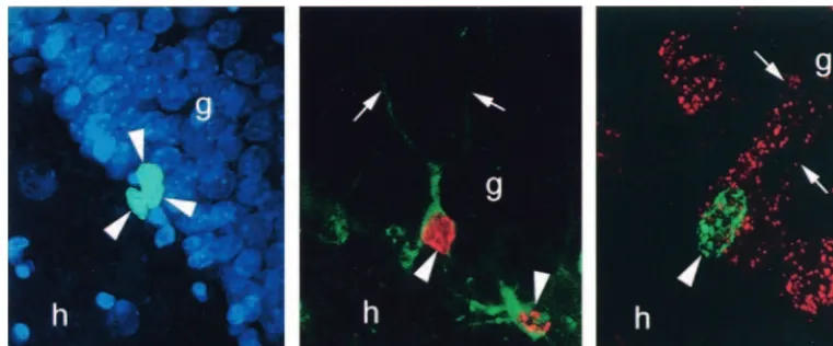 Figure 1. Bromodeoxyuridine (BrdU)–labeled cells in the dentate gyrus of the adult rat