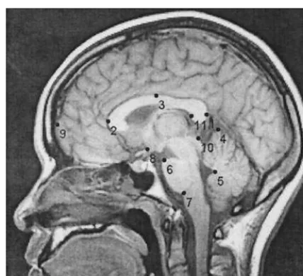 Figure 1. The locations of the landmarks used in the presentstudy. 1, outside of splenium; 2, genu; 3, midpoint of corpuscallosum; 4, top of cerebellum; 5, tip of fourth ventricle; 6, topof pons; 7, bottom of pons; 8, optic chiasm; 9, frontal pole (on thee