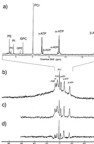 Figure 2. (a)duced with permission from Stanley etbrain acquired with a single radio fre-quency pulse and different preacquisi-tion delay times— Phosphorus (31P) spec-trum of a perchloric acid extract of afreeze-clamped rat brain acquired at11.7 T