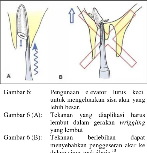 Gambar 6 (A): 