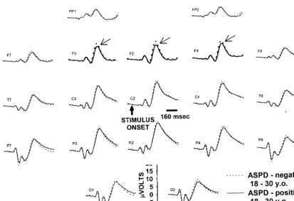 Figure 3. Frontal P300 amplitude for the target and rare nontar-get conditions plotted as a function of group (antisocial person-ality disorder [ASPD]-negative, ASPD-positive) and age.