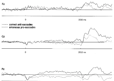 Figure 4. Single subject average for correct antisaccades and erroneous prosaccades during the antisaccade task, with the samesignal-to-noise ratio (average over 30 trials) for both types of saccades.
