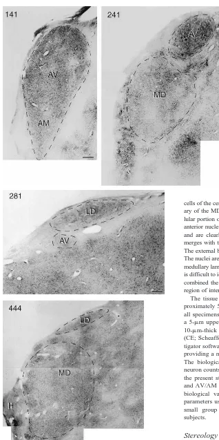 Figure 1. Photomicrographs of Nissl-stained coronal sections of the thalamusin control case C
