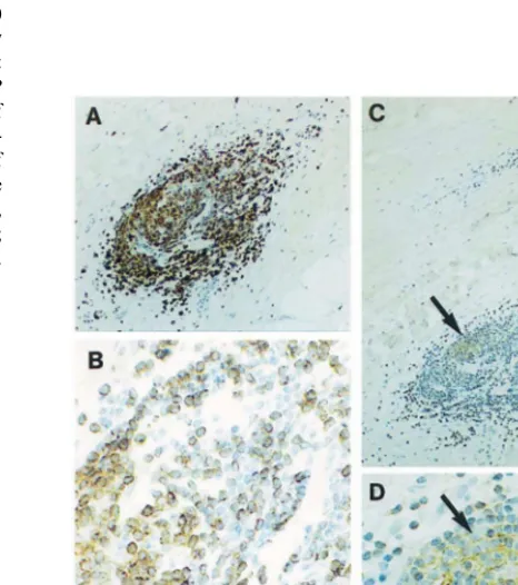 Fig. 2. Immunohistochemical identiﬁcation of dendritic cells andvisualisation of their contacts with T-cells within an adventitial×inﬂammatory inﬁltrate