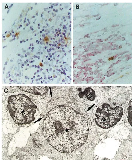 Fig. 4. Immunohistochemical (A, B) and electronmicroscopic (C)visualisation of dendritic cells and their contacts with T-cells at thelymphocytes (asterisks) around a dendritic cell (star)