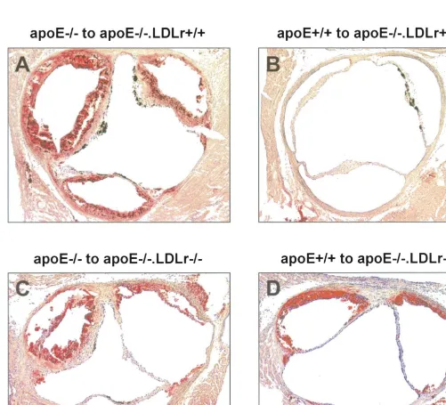 Fig. 3. Photomicrographs of atherosclerotic lesions in cross sections of the aortic root, illustrating the effect of reconstitution of macrophage apoEproduction in apoEplanted with either apoEcounterstained with hematoxylin
