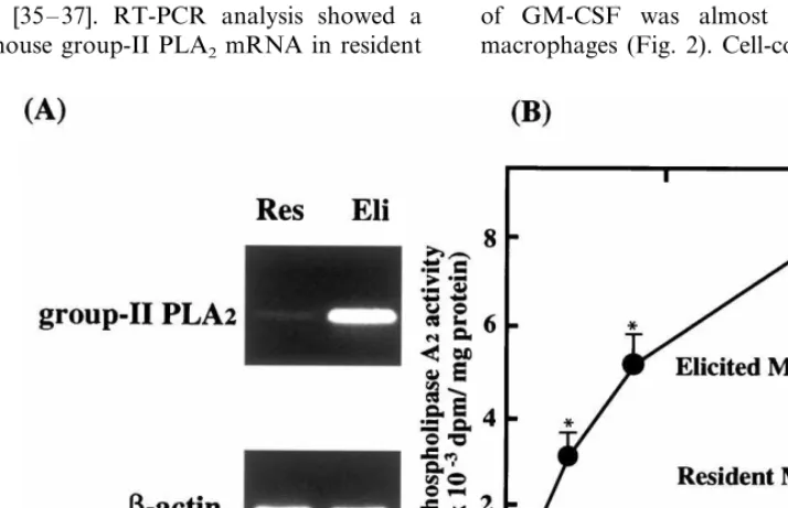 Fig. 1. Polymerase chain reaction (PCR) analysis of mouse group-II phospholipase A2as described in Section 2