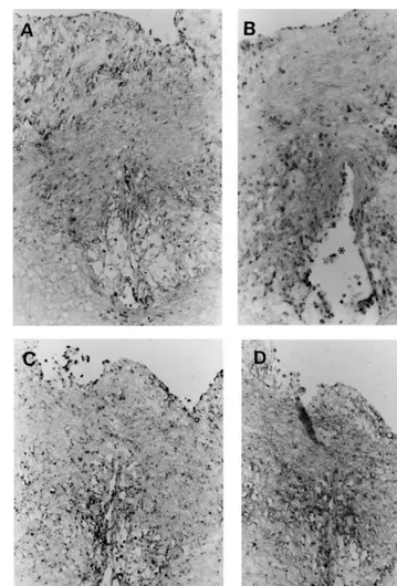 Fig. 8. In situ hybridization of the sections from animals in the atherosclerotic group sacriﬁced on day 56