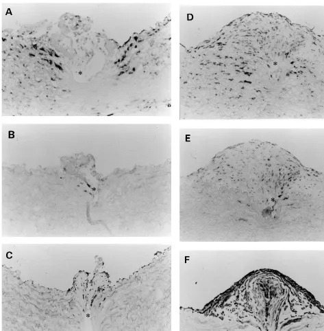 Fig. 5. Biglycan (A, D and G) and TGF-� (B, E and H) mRNA in situ hybridization in the control group compared with SMemb immunostaining(C, F and I)