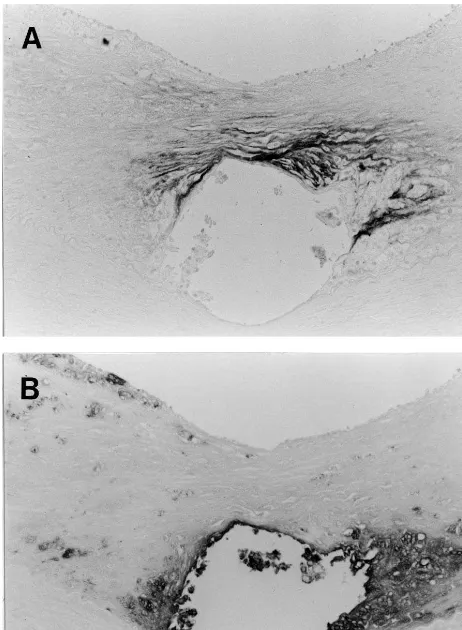 Fig.6.Immunohistochemicalstainingfordecorin(A),andmacrophages (B) on day 56 after stent implantation in the atheroscle-rotic group