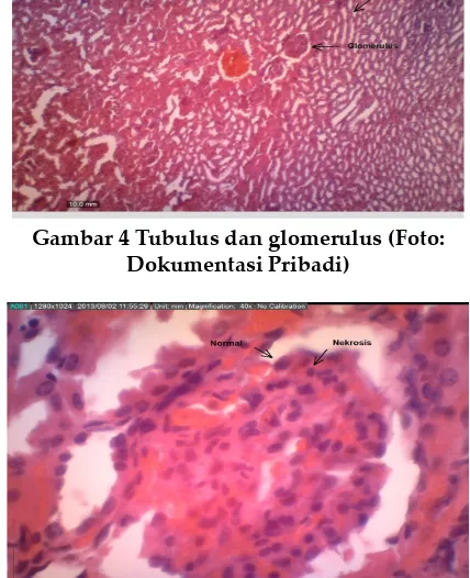 Gambar 4 Tubulus dan glomerulus (Foto: 