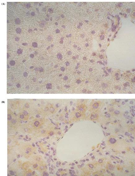 Fig. 2. Immunohistochemical analysis of T�R-II expression in the liver of NC and HC mice after 15 weeks of atherogenic diet
