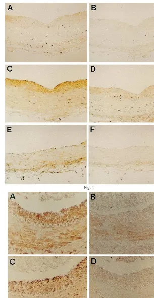Fig. 1. Photomicrographs showing immunohistochemical staining of balloon-injured rat thoracic aorta (A, B, C and D) and uninjured rat thoracicaorta (E and F)