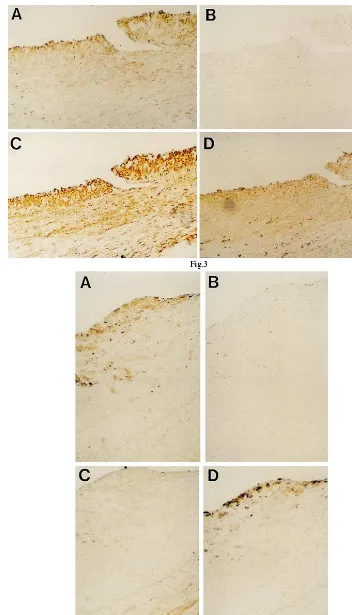 Fig. 3. Photomicrographs showing immunohistochemical staining of a restenotic lesion of human coronary artery after percutaneous transluminalcoronary angioplasty obtained at directional coronary atherectomy