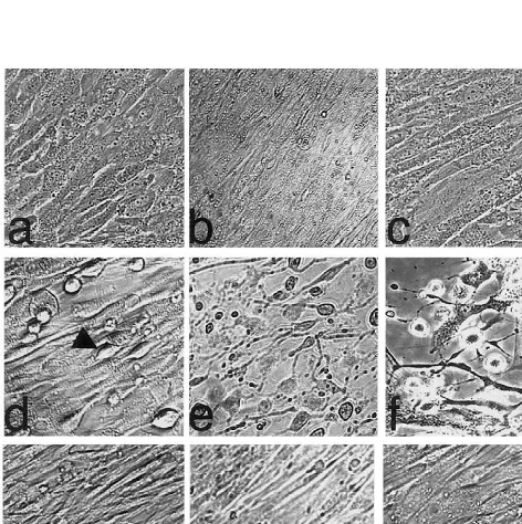 Fig. 1. Effect of sFasL or cytokines on the morphology of statin-treated SMC. SMC were treated with the cytokine cocktail of TNF-(panels d–f) or 20f, i) in the absence (panels a–c) or presence of 3IFN-treated with statins for 24 h and then stimulated with 