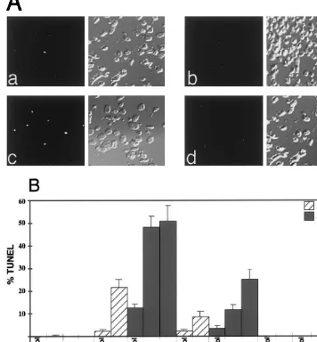Fig. 2. Induction of TUNEL staining in lipophilic statin-treated cells following stimulation with sFasL or cytokines