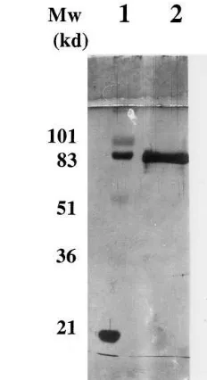 Fig. 1. Western blot analysis of human plasma with anti-PLTPantibodies. Plasma samples (1puriﬁed PLTP were subjected to SDS–PAGE analysis on 12.5%polyacrylamideproteins were transferred onto nitrocellulose sheets