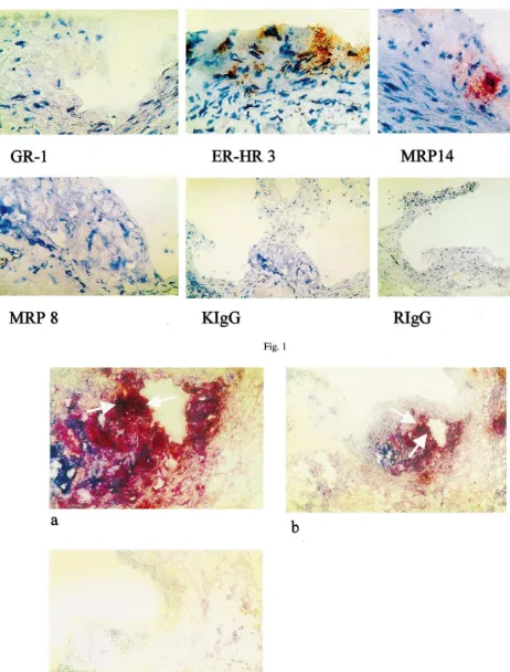 Fig. 1. Immunohistochemical staining of atherosclerotic lesions of 6-month-old ApoE −/−Gr-1),(monocyte mice with Gr-1 (granolocyte marker), ERHR-3/macrophage marker), anti-MRP14, anti-MRP8 and isotype controls in the appropriate dilutions (1 �g/ml)