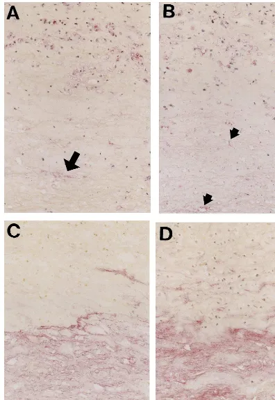 Fig. 3. Comparative immunostaining of the CML (A)-, oxPC (B)- and nonCML (C)-epitopes and apolipoprotein B (D) in the atheroscleroticplaques from a 68-year-old subject