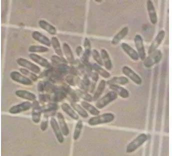 Gambar 7. Konidia C. gloeosporioides Perbesaran 40x 