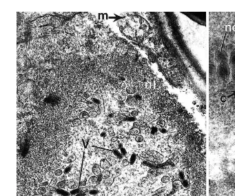 Fig. 14. Transmission electron micrograph of WSBV-infected gill epithelial cells of 100-day-old P