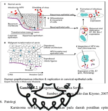 Gambar 2.2. Patogenesis Karsinoma Serviks 